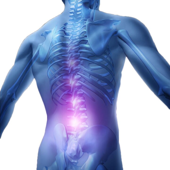 Muscle spasms and muscle strains cause severe pain